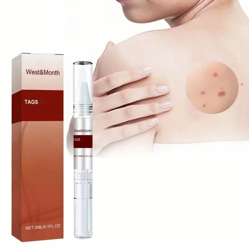 Skin Tag Removal Pen-Skin Tag Removal Pen