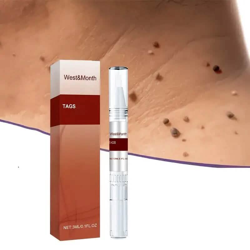 Skin Tag Removal Pen-Skin Tag Removal Pen