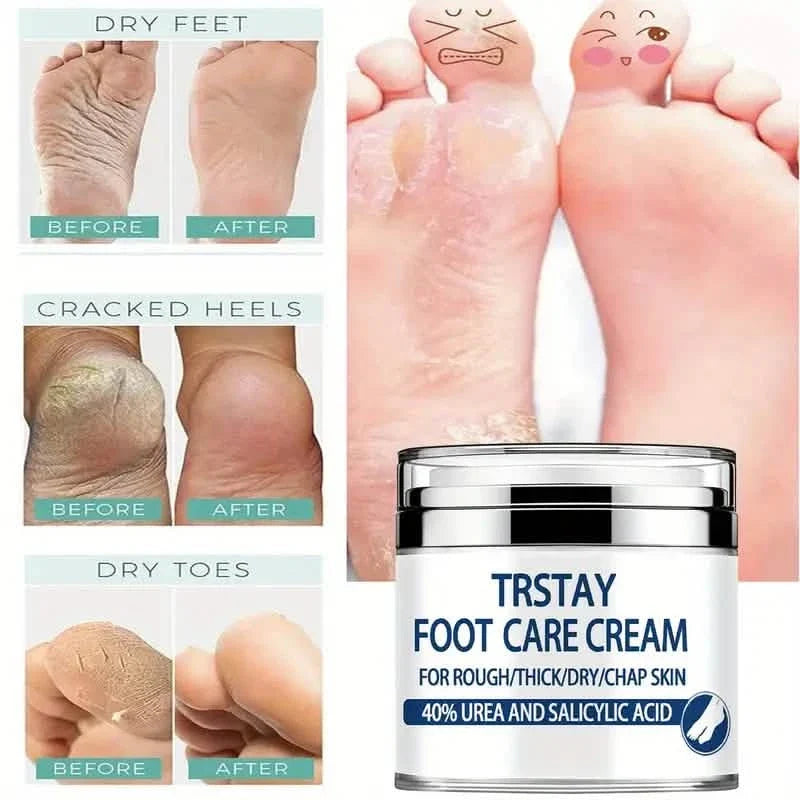 Trstay Foot Care Cream50g/ Foot Care Cream 40 Urea And Salicylic Acid-Trstay Foot Care Cream50g/ Foot Care Cream 40 Urea And Salicylic Acid