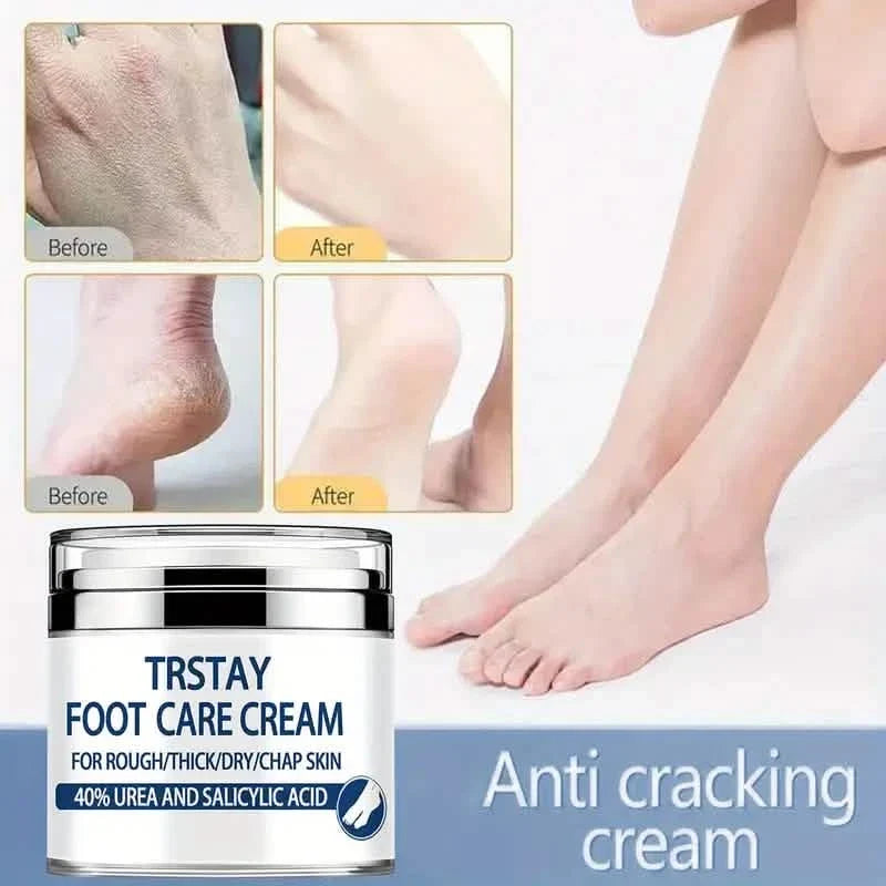 Trstay Foot Care Cream50g/ Foot Care Cream 40 Urea And Salicylic Acid-Trstay Foot Care Cream50g/ Foot Care Cream 40 Urea And Salicylic Acid