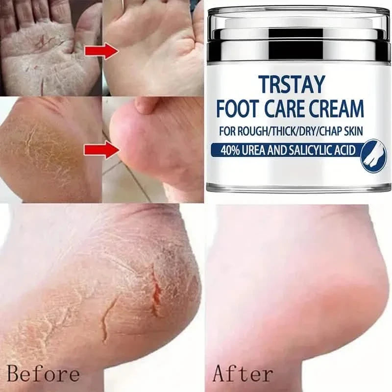 Trstay Foot Care Cream50g/ Foot Care Cream 40 Urea And Salicylic Acid-Trstay Foot Care Cream50g/ Foot Care Cream 40 Urea And Salicylic Acid