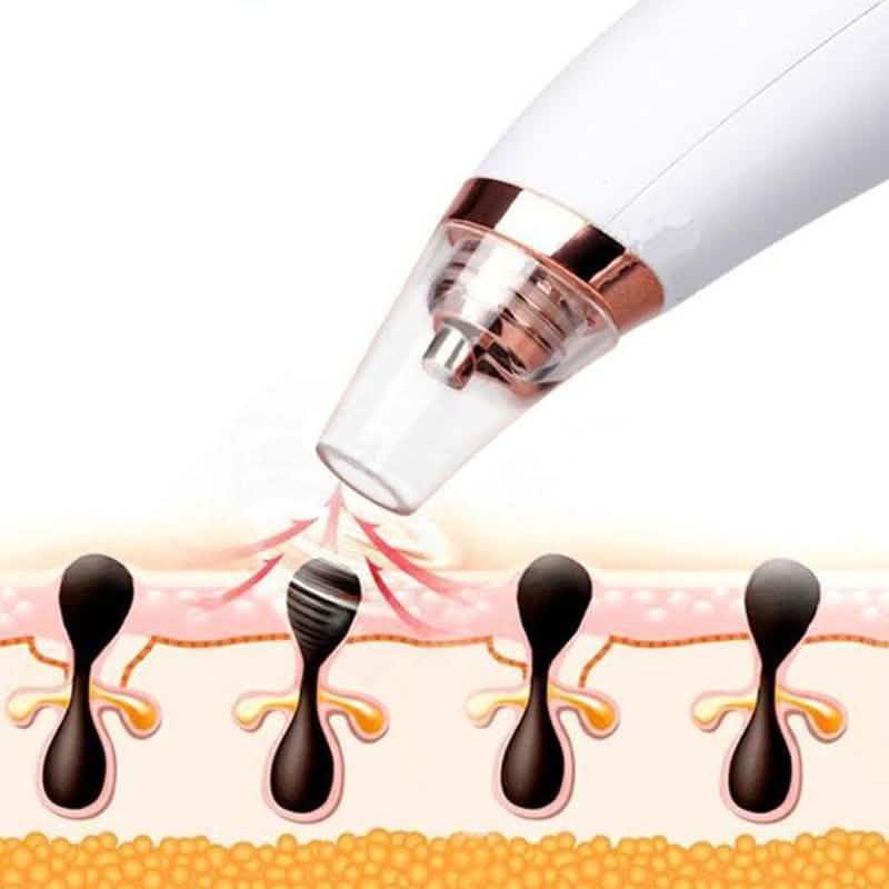 Visual Pore Cleaning Vacuum with Built in Camera-Visual Pore Cleaning Vacuum with Built in Camera