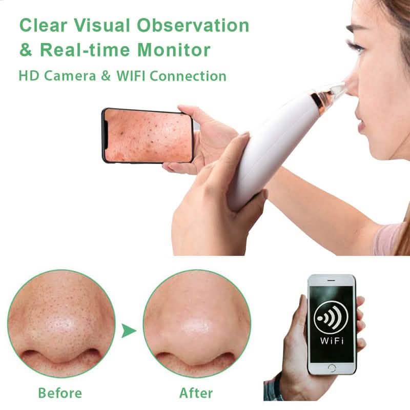 Visual Pore Cleaning Vacuum with Built in Camera-Visual Pore Cleaning Vacuum with Built in Camera
