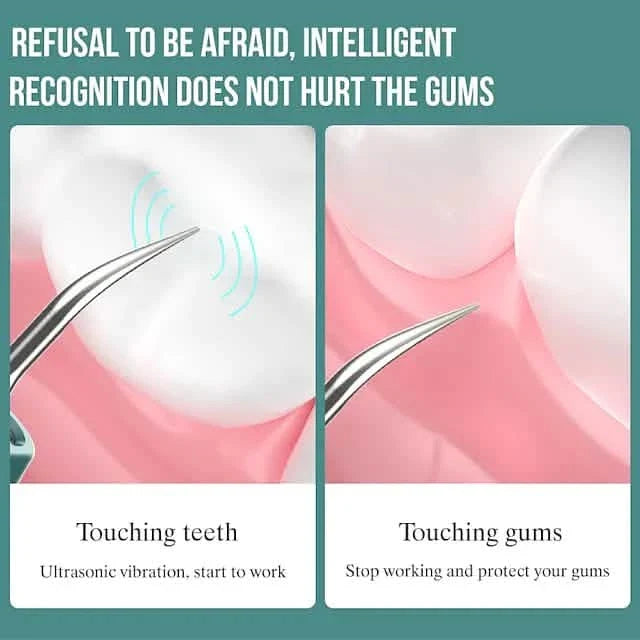 Visual Ultrasonic Teeth Cleaner-Visual Ultrasonic Teeth Cleaner